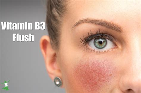 vitamins for rosacea flushing.